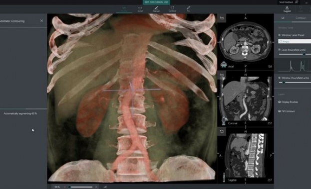 Изследователското подразделение на Microsoft разработва иновативна технология за откриване на