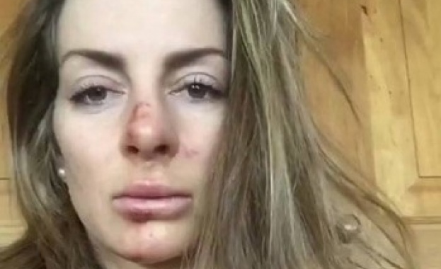 Александра Жекова падна лошо на трасето във Вейзонас Най добрата