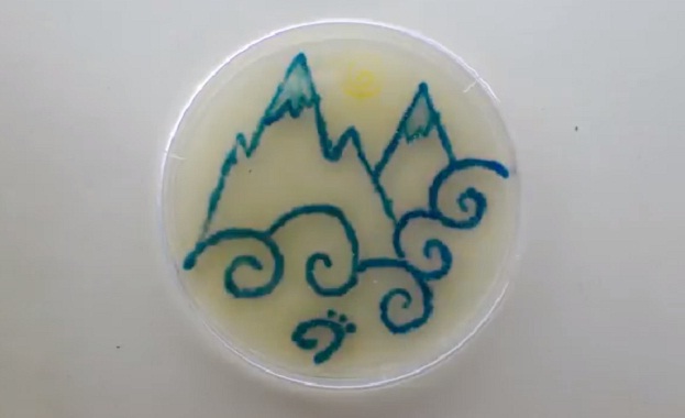 Когато стане въпрос за изкуство микробите и бактериите не са