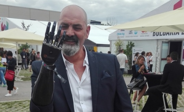 През 2006 г Найджъл Акланд остава без дясната си ръка