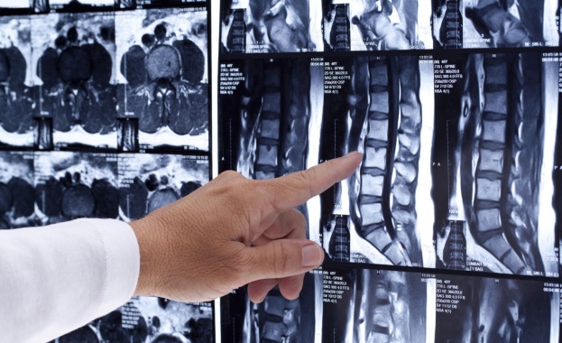 Италиански лекари са първите в света които успешно са трансплантирали