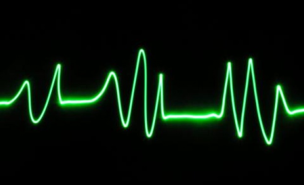 Кардиолог: Над 50% от инфарктите у нас водят до инвалидност  