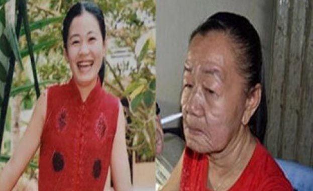 Непозната алергия състари китайка за няколко дни с 50 години 