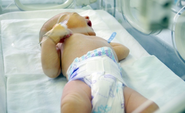 Успешно разделиха 10-месечни сиамски близначки  