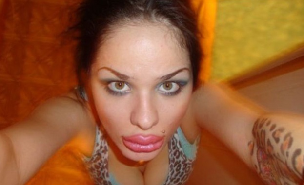 Рускиня си направи най-големите силиконови устни 