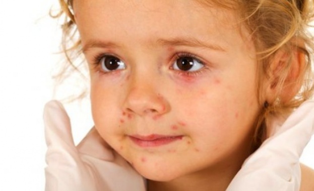 Опасна шарка пламна в Бургас 