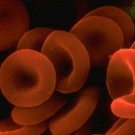 Наночастици атакуват резистентния към лечение рак на гърдата