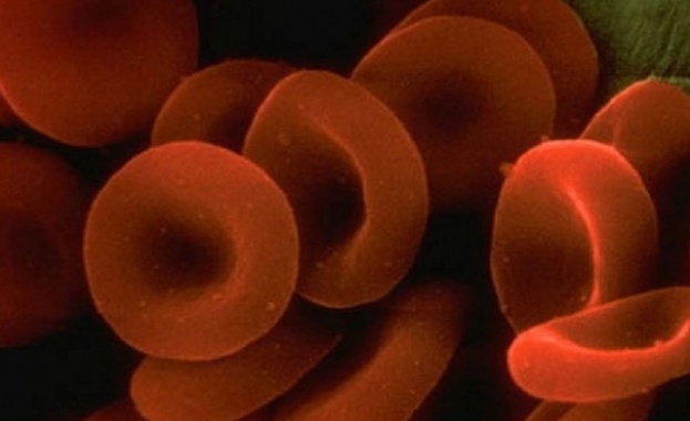 Стресът е неизбежен Но прекомерното му въздействие може да доведе