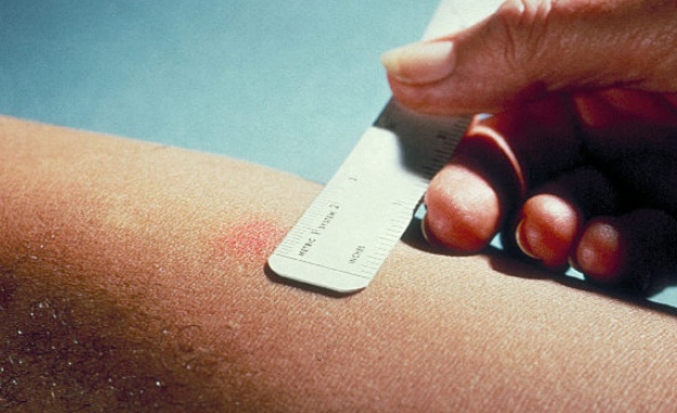 Коледната елха буди алергии 