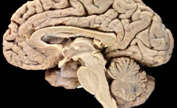 Младеж крадял мозъци и ги продавал в e-Bay