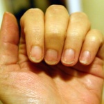  Учени сравняват гризането на ноктите с ваксина