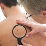 Кожата често сърби на нервна почва