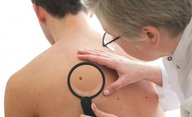Безплатни прегледи за рак на кожата в ДКЦ “Софиямед“