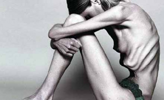 Анорексия уби млада фелдшерка от Айтос