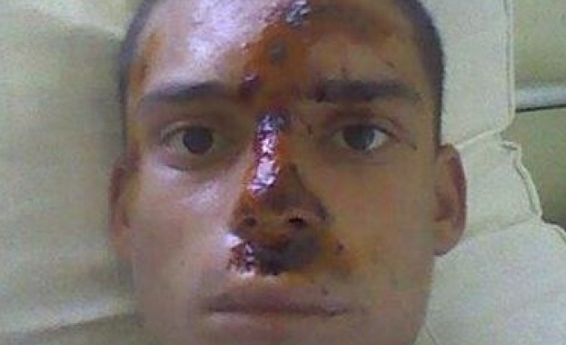 Роми пребиха момче заради патриотичен надпис 