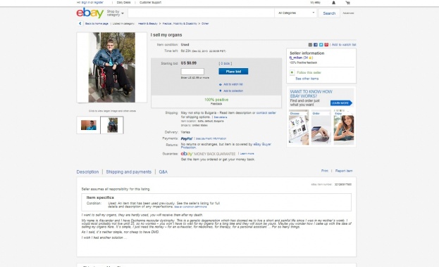 Българин, болен от мускулна дистрофия, продава органите си в eBay