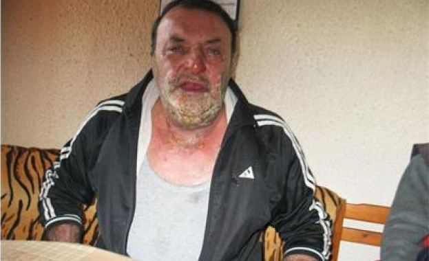 Самозапалилият се в ТЕЛК: Бюрокрацията ме докара до безизходица