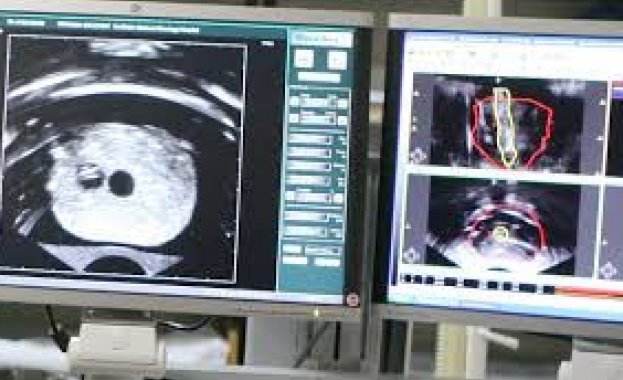 доц. Николов: Ракът е лечимо заболяване