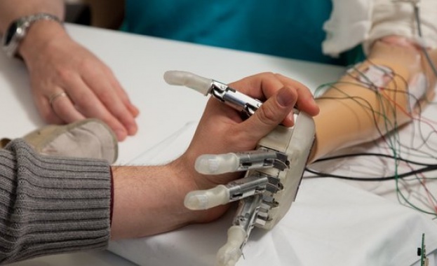 Уникална протеза позволява на човек с ампутирана ръка да усеща