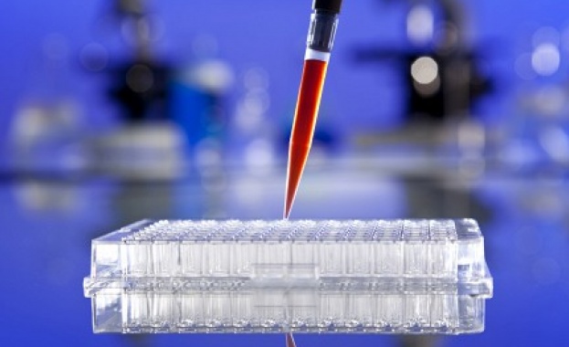 Предсказват появата на Алцхаймер чрез кръвен анализ 