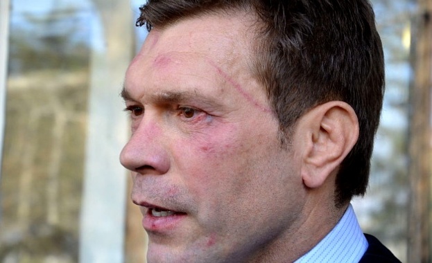 Жестоко пребиха кандидат за президент на Украйна 