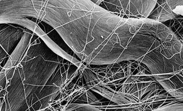 Колагенът е основен фактор за добро здраве 