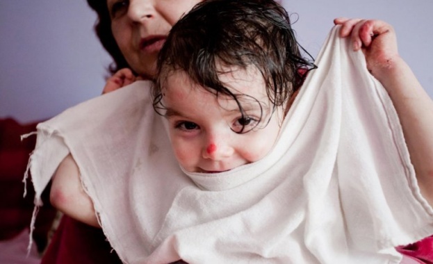 Здравната каса отново увери, че ще се грижи за пеперудените деца