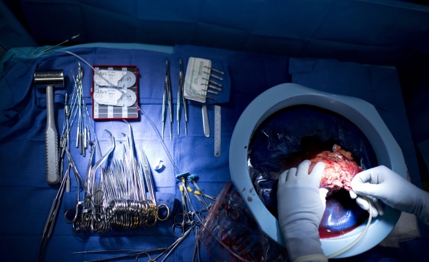  Четири нови трансплантации за 2014 година