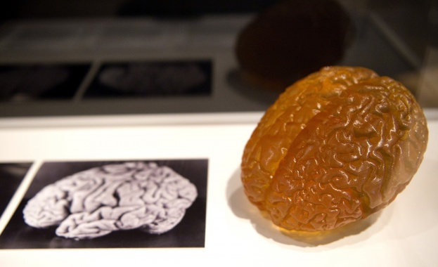 Антидепресантите променят мозъка