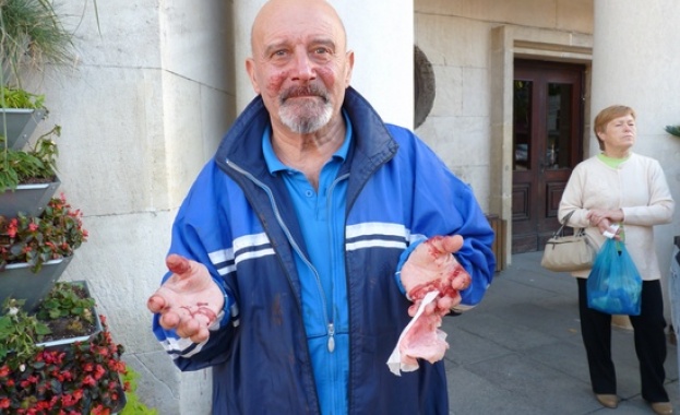 Разбиха носа на активист на Реформаторите 