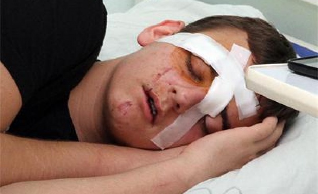 Фенове на „Локомотив” Пд пребиха 16-годишно момче