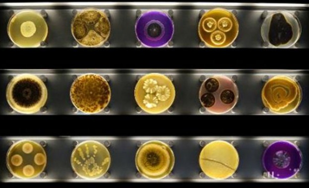 Музей на микробите отваря врати в Амстердам