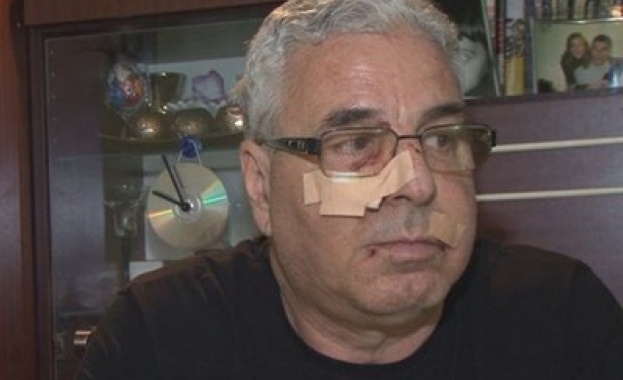 16-годишен преби мъж в бургаски автобус