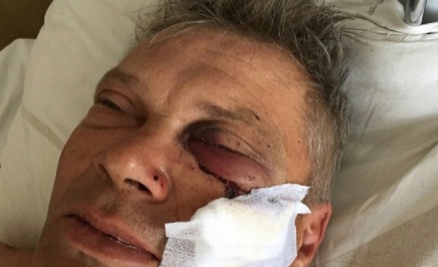 Роми пребиха 45-годишен руснак и сина му в околностите на Петрич