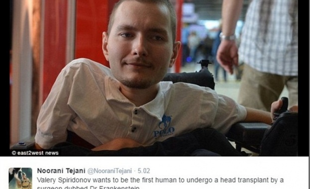 Насрочиха първата операция за трансплантация на глава за 2017 година 