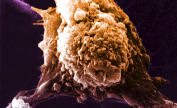 Първите тестове на универсална ваксина за рак са успешни