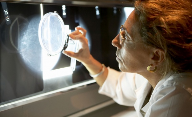 Безплатни профилактични прегледи за рак на гърдата в Елена