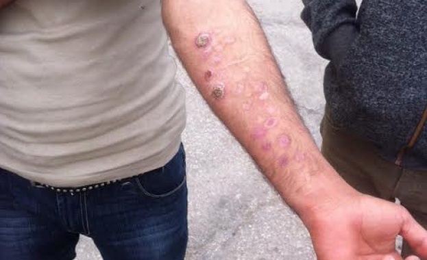 Манолова иска лекарска проверка в бежанския лагер в Харманли