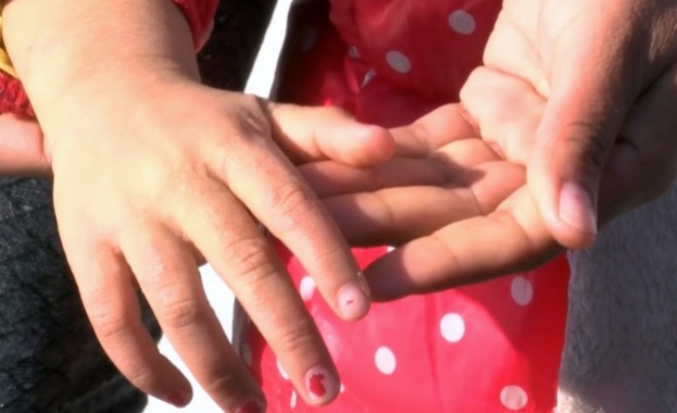Родители съобщават за случаи на краста в детска градина в старозагорско