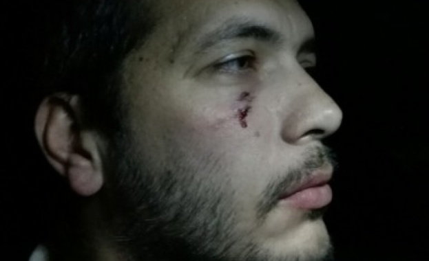 Нападнаха журналист и оператор на магистрала "Тракия"
