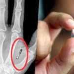 Американска компания ще вгражда чипове в служителите си