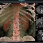 Технология на Microsoft открива рак за 30 секунди (видео)