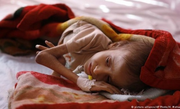 Всеки четвърти човек в Йемен е заплашен от гладна смърт