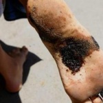 Мазут на четири плажа по Южното Черноморие