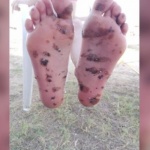 В разгара на лятото: Мазут на плажа в Созопол и Смокиня