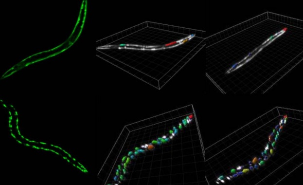 Идентифицираха механизъм, свързан със стареенето