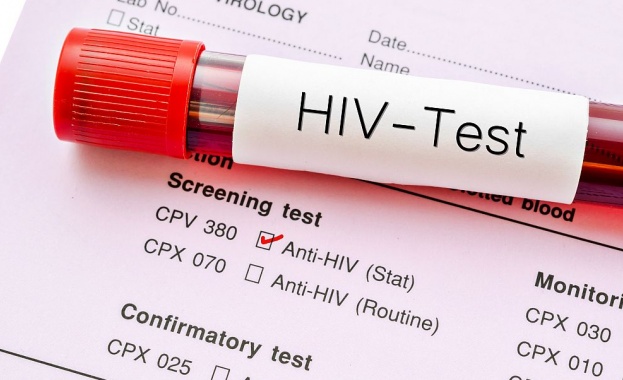 Увеличават се новите случаи на зараза с вируса ХИВ в Източна Европа 