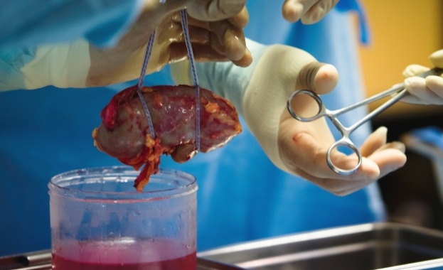 Две чернодробни трансплантации бяха извършени в болница „Лозенец и една