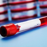 Ще взимат кръвни проби от изпълнителите на „Евровизия” 2019