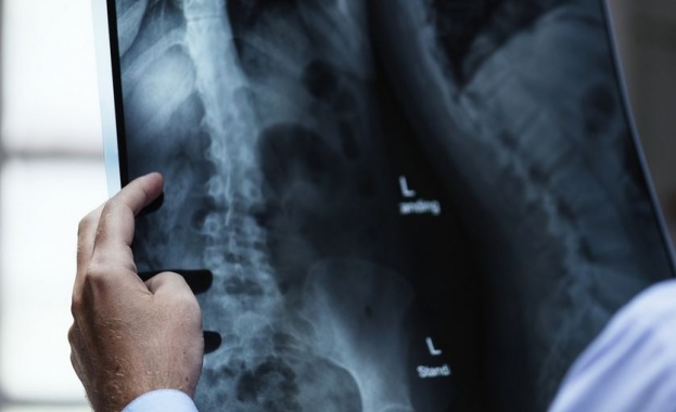 Пациенти с COVID 19 с часове за рентген в болницата в